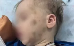 Появились подробности дела по истязанию ребенка собственной матерью в Петропавловске