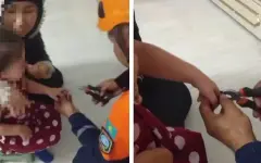 Трехлетняя девочка в Актобе едва не лишилась пальца из-за игрушки