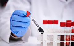 Жителей Узбекистана могут обязать сдавать тест на ВИЧ после поездок за границу