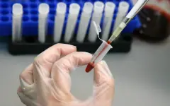 Массовая вспышка гепатита А за последние 15 лет зафиксирована в Чехии