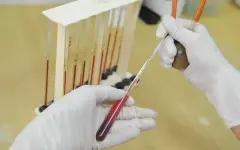 Посмертное донорство: сердце и почки пересадили казахстанским пациентам из листа ожидания