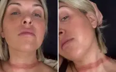 Блогер из Австралии едва не повторила трагическую гибель Айседоры Дункан