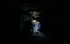 Врачи извлекли из мозга мужчины живого червя длиной 18 сантиметров