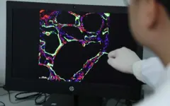 ИИ за минуту диагностирует рак легких с точностью до 90%