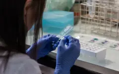 Власти Алматинской области прокомментировали ситуацию по сибирской язве в селе Байсерке