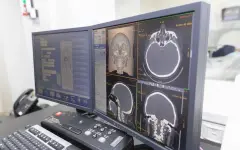 Компьютерную томографию разрешили применять казахстанским судмедэкспертам