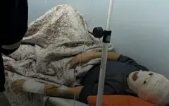 Мужчина получил ожоги на АЗС в Бейнеуском районе