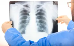 Проверку провели в школе Костанайской области после выявления случая туберкулеза